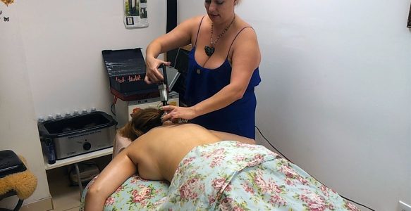 Massage In Miami Beach Cupping Video